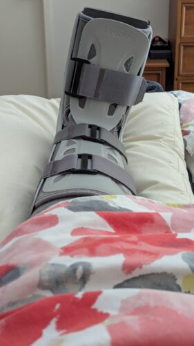 Leg in CAM boot elevated on cushions
